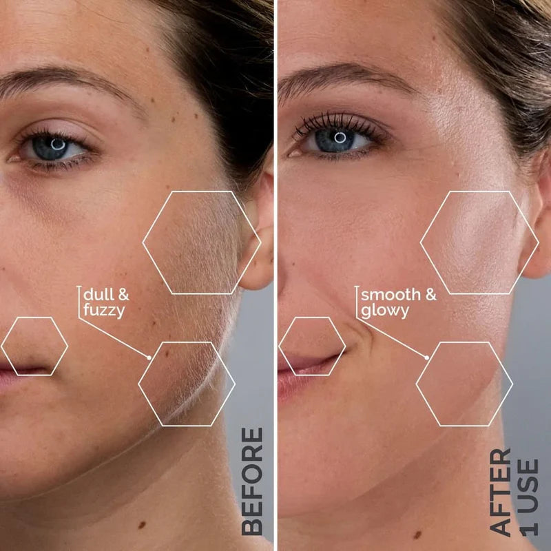 Trim Pod 3.0 : The Best Dermaplaning Tool For Women Over 40